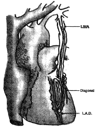 101_Arterial conduits.png