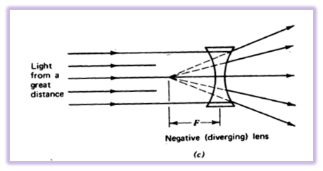 1089_Defects of vision and their correction 3.png