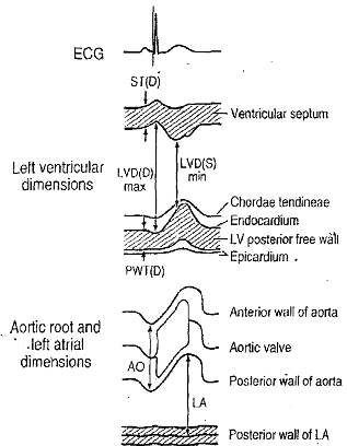 1441_M - Mode Echocardiography.png