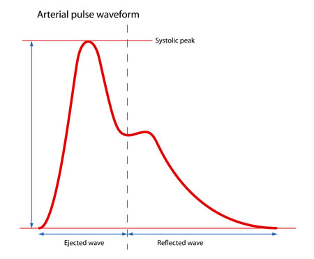 1564_arterial-pulse-waveform-s.jpg