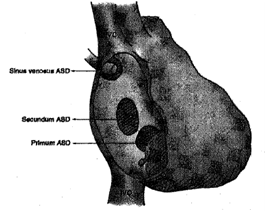 1685_Anatomical location of Am.png