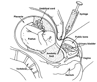 1732_misuse of biology.png