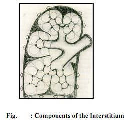 1909_Pulmonary Edema.png