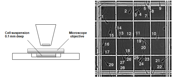 2279_hemocytometer.png