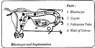 25_Implantation.png