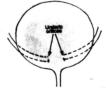 692_What is the structure of the urinary bladder.png