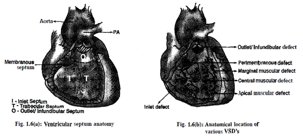 983_ventricular.png